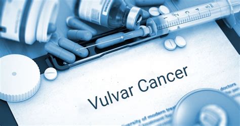 Symptoms Of Vulvar Cancer Facty Health