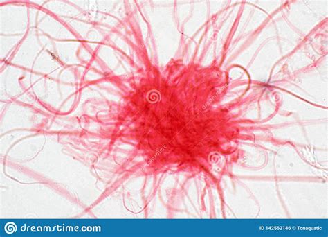 Cancer Cell In Human Under The Microscope View Stock Photo Image Of