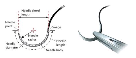 Suture Materials Suture Size Absorption Time Suture Needles And