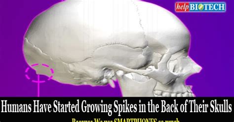 We Are Growing Spikes In The Back Of Skulls Because Of Excessive Usage