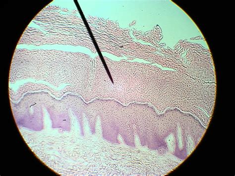 Keratinized Stratified Squamous Epithelium 10X Mrs Sandy Flickr
