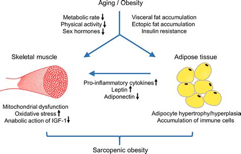 Growing Menace Of Sarcopenic Obesity A South Asian Perspective Cme