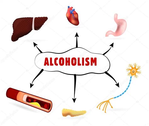 Dibujos: efectos del alcohol ilustraciones | Efectos físicos del alcoholismo — Vector de stock ...