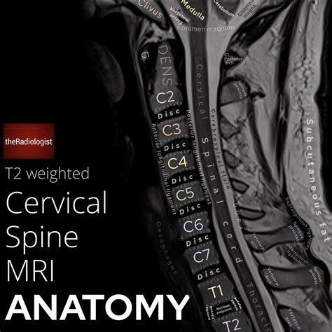 Cervical Spine Mri Anatomy Sagittal T Weighted By Grepmed