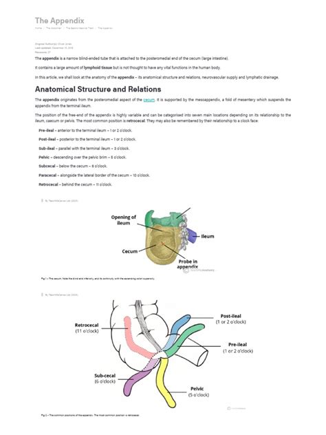 The Appendix Retrocecal Arterial Supply Appendicitis