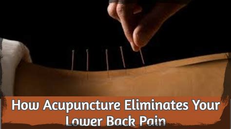 How Acupuncture Eliminates Your Lower Back Pain Youtube