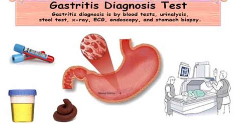 Tests For Gallbladder Problems Diagnostic Tests For Gallbladder Disease
