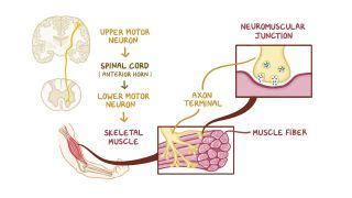 Muscle Spasms What Are They Causes Diagnosis And More Osmosis