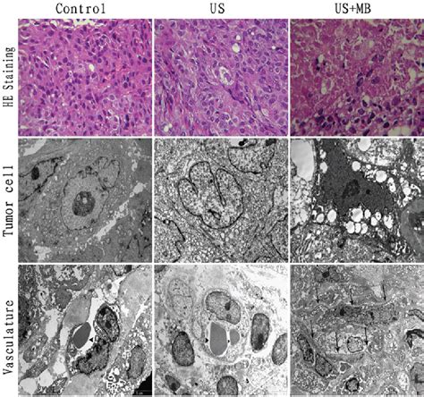 Figure 1 From Inhibitory Effects Of Subcutaneous Tumors In Nude Mice