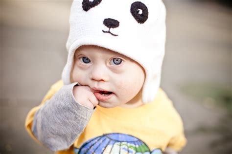 Down syndrome baby down syndrome medical photography baby pictures precious children children cute kids baby love children photography. Down Syndrome Screening Test: Here's 25,000 Reasons Not To ...