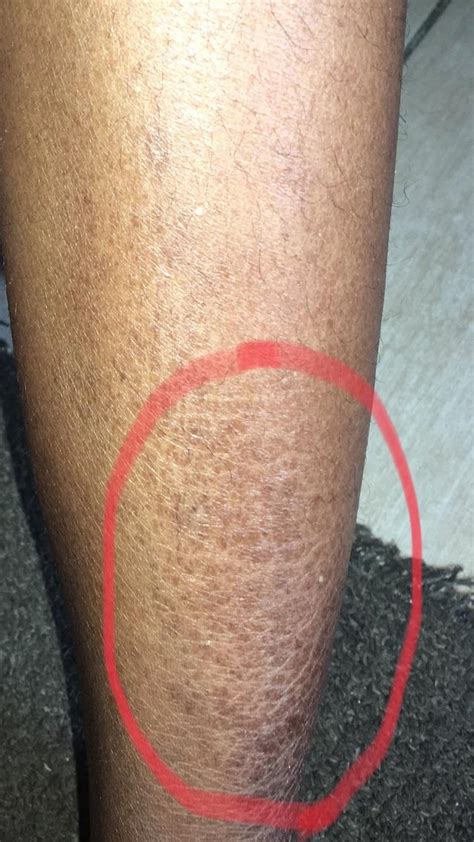 Skin Concern Need Help With My Extremely Dry Legs Skincareaddiction