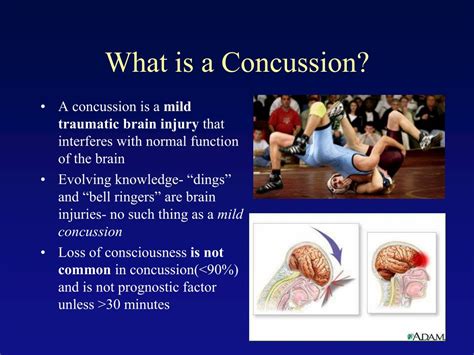 Ppt 2013 Sports Concussion Management Powerpoint Presentation Free