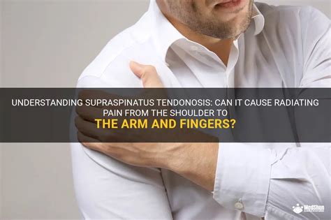 Understanding Supraspinatus Tendonosis Can It Cause Radiating Pain