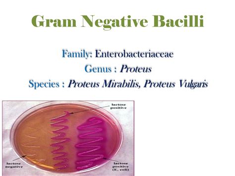 Ppt Gram Negative Bacilli Powerpoint Presentation Free Download Id