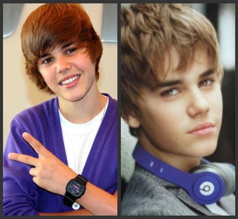 celebrity justin bieber before and after celeb surgery