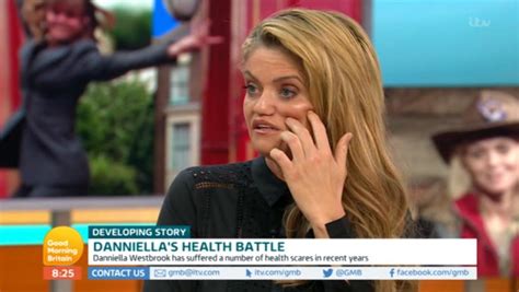 danniella westbrook reveals doctors will put a piece of her rib in her face to fix osteoporosis