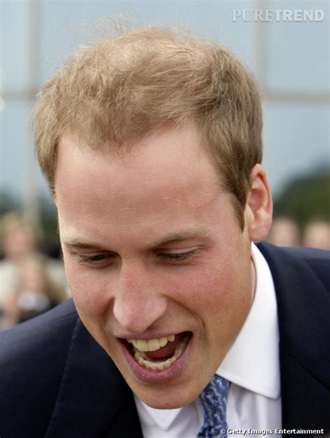 Le prince william est le fils aîné de lady diana et du prince charles. Le prince William semble avoir quelques soucis de ...
