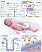 Frontiers | Immunomodulation to Prevent or Treat Neonatal Sepsis: Past ...