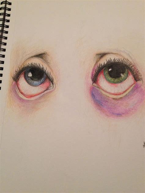Tired Eyes Artwork