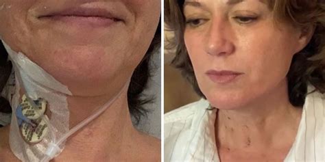 Amy Grant Shares Scar Photo After Emergency Open Heart Surgery