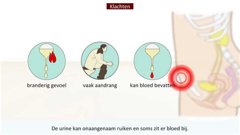 Blaasontsteking Oorzaak En Behandeling Youtube