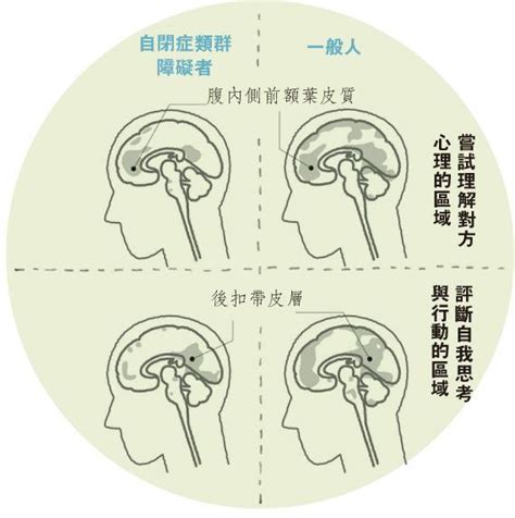 For faster navigation, this iframe is preloading the wikiwand page for 亞氏保加症. 通識導賞﹕患亞氏保加症都可以是好醫生! 比一般人更老實認真 - 20180826 - CULTURE & LEISURE - 明報OL網