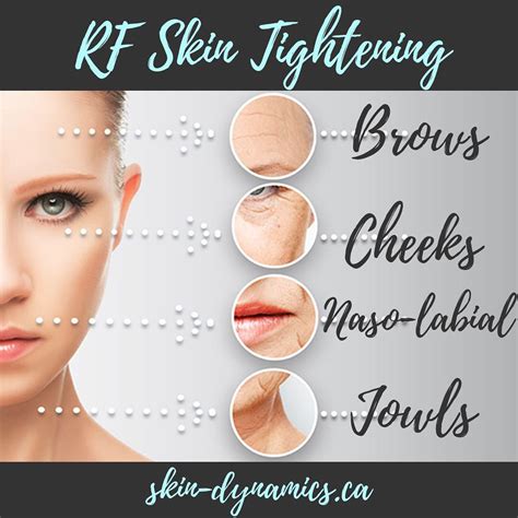 Rf Skin Tightening A Non Surgical Facelift