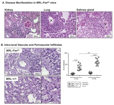 Dominant Vascular Manifestations On Mrl Fas Lpr Lupus Mouse Model A