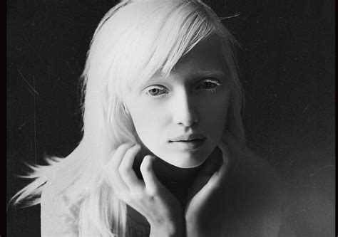 Nastya Kiki Zhidkova Simply Beautiful Beautiful People Lovely Modelo Albino Half Elf Albino