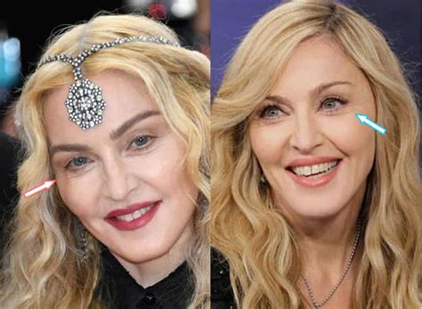 Мадонна Последние Фото После Пластики Telegraph