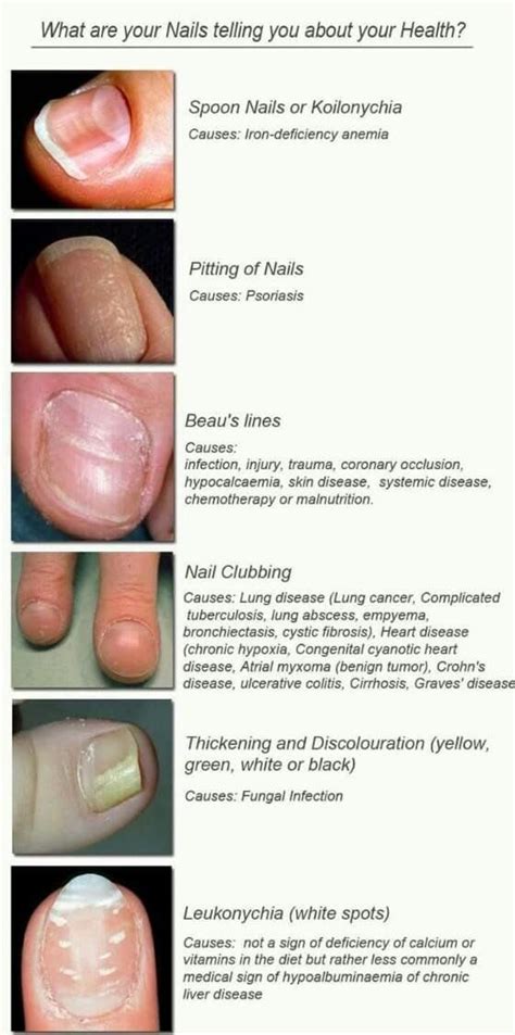 Nail Disorders A Visual Reference Table Foamed Nail Diseases And Disorders Nail Disorders