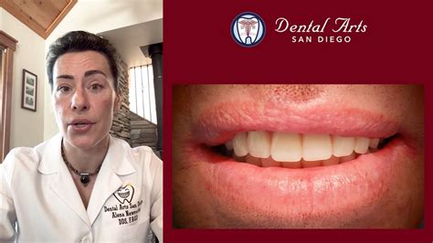 Dental Case Studies Dental Arts San Diego