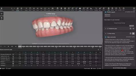 Carriere Motion Appliance Invisalign Youtube