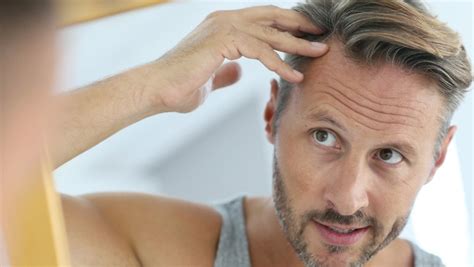 Jak ukryć zakola odpowiednią męską fryzurą na co dzień
