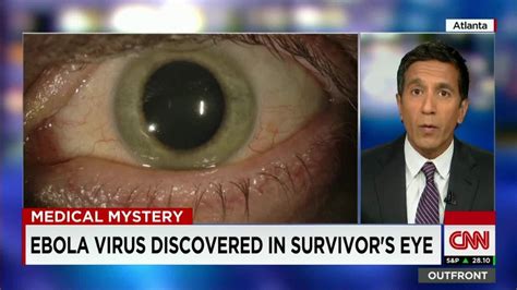 Ebola Found In Eye Months After Recovery Cnn Video