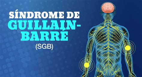 GRÁFICA Datos sobre el Síndrome de Guillain Barré Wayka