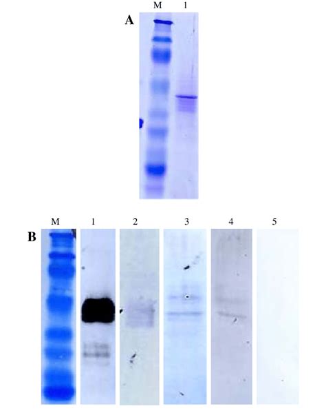 Western Blotting A A Coomassie Stained 12 Sds Page Gel Showing The