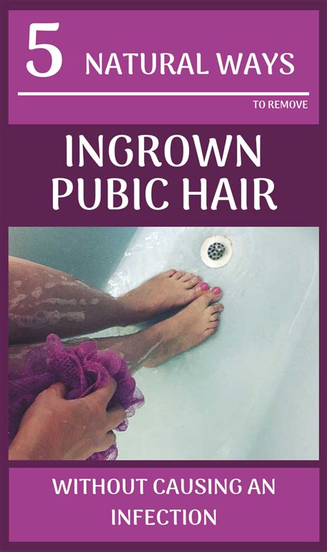 How To Prevent Ingrown Hairs After Waxing Pubic Area