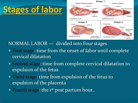Ppt First Stage Of Labor Powerpoint Presentation Free Download Id