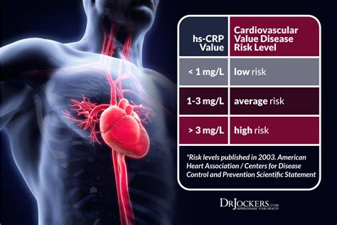 Heart attacks and strokes are not so much about ldl but more about cv inflammation—that's what ridker there are various tests for that, though there's no single definitive test for cv inflammation. Measuring Your C Reactive Protein Levels - DrJockers.com