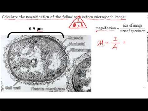 Calculating Magnification Ib Biology Youtube