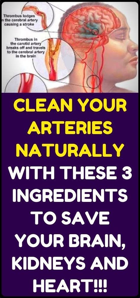 how to clean out plaque in arteries 3 ingredients mixture health tips arteries health advice