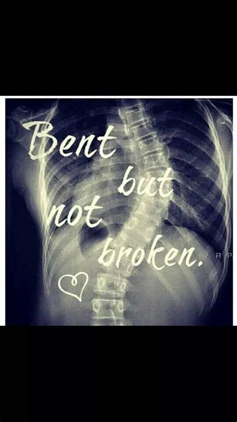 11 Best Inspirational Scoliosis Quotes Images On Pinterest Scoliosis