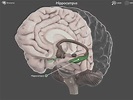 Brain Posts: Brain Hippocampus Atrophy in Traumatic Brain Injury
