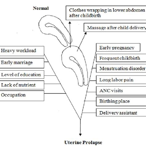 Prevalence Of Uterine Prolapse In Nepal Download Scientific Diagram