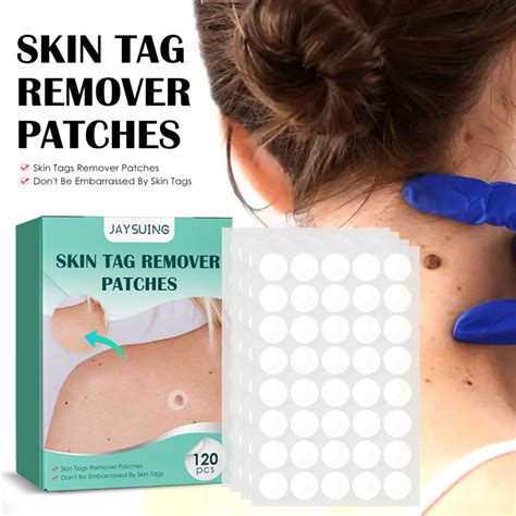 Skin Tag Removal Patch Wise Living