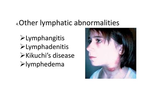 Clinical Approach To Lymphadenopathy Ppt Download
