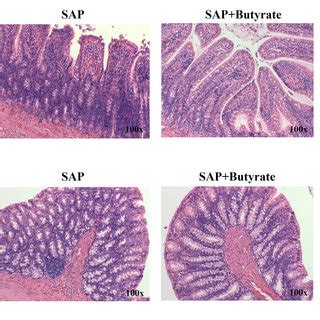 The Effect Of Butyrate On Intestinal Injury Control Control Group