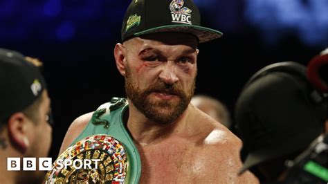 Tyson Fury V Otto Wallin Bloodied British Fighter Takes Points Victory