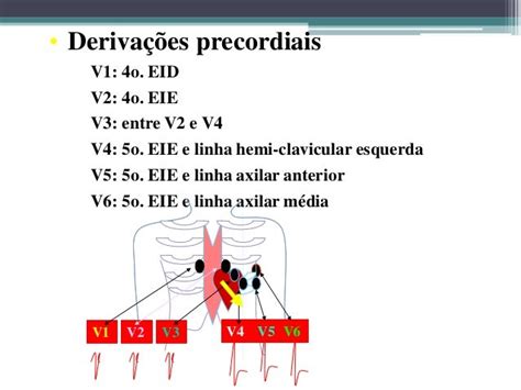 Noções De Eletrocardiografia